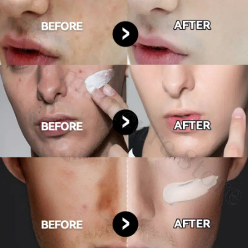 MANCODES Crema BB para Hombres | Cobertura Natural con Ácido Hialurónico 50g